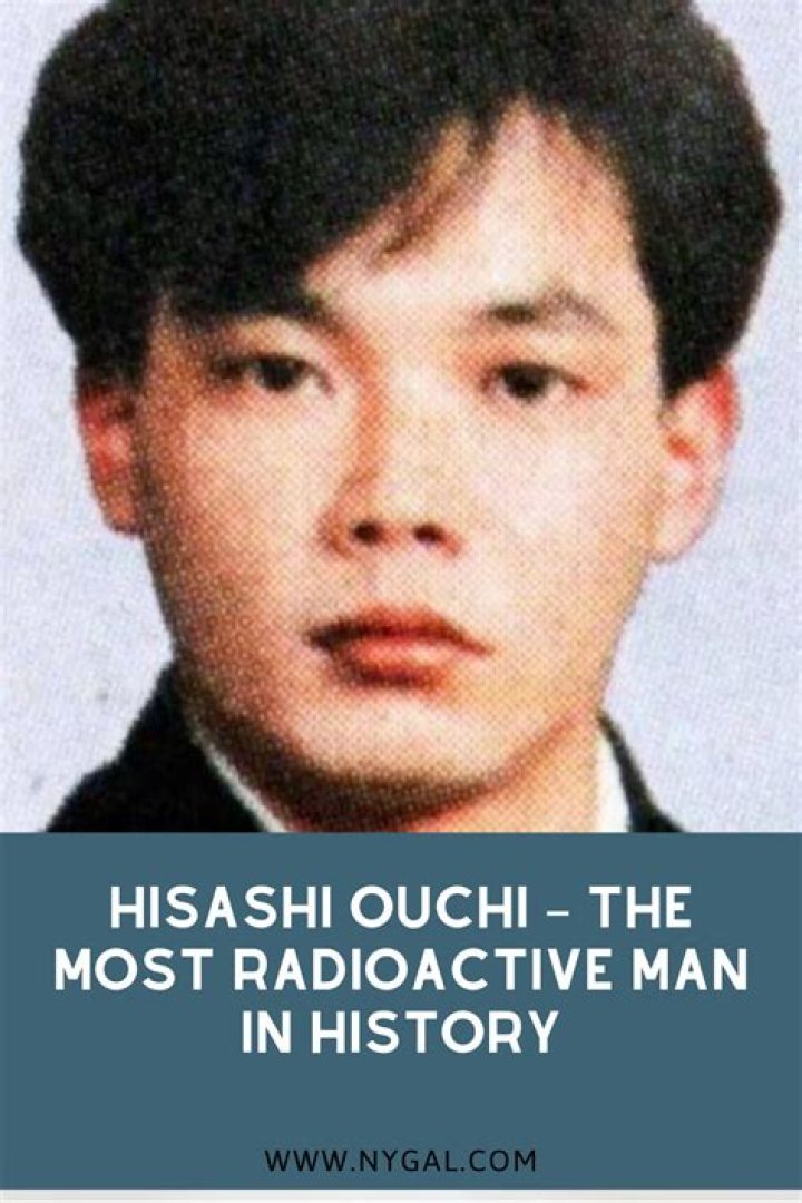 Hisashi Ouchi Biography: The Untold Story of a Nuclear Tragedy Survivor