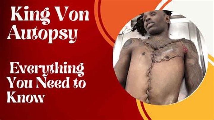 King Von Autopsy Real: Unveiling the Truth Behind the Tragic Loss
