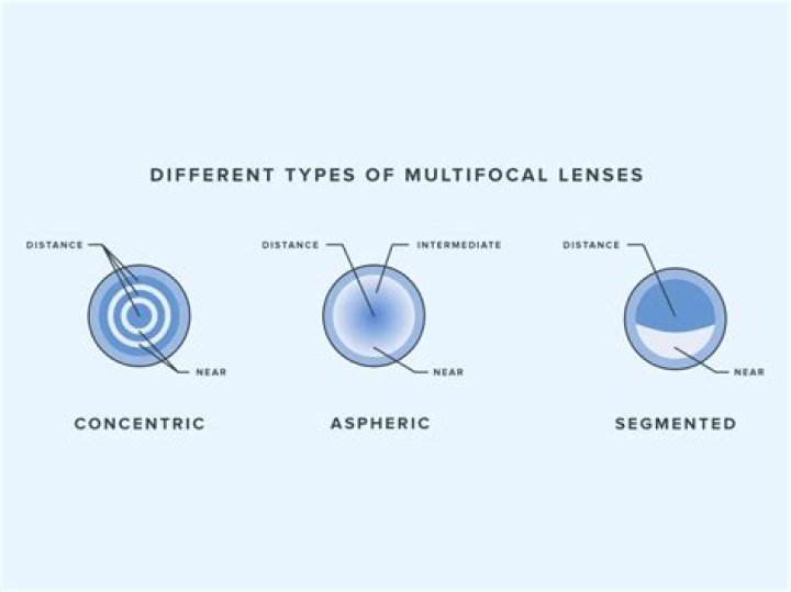 What Do Contact Lenses Feel Like? A Comprehensive Guide