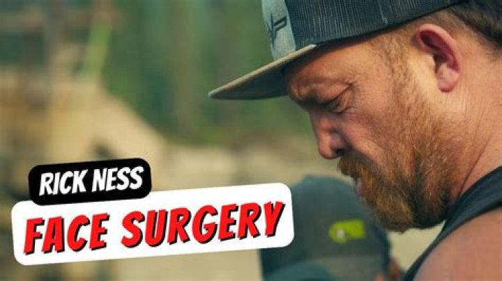 What Happened to Rick Ness's Face: The Truth Behind the Mystery
